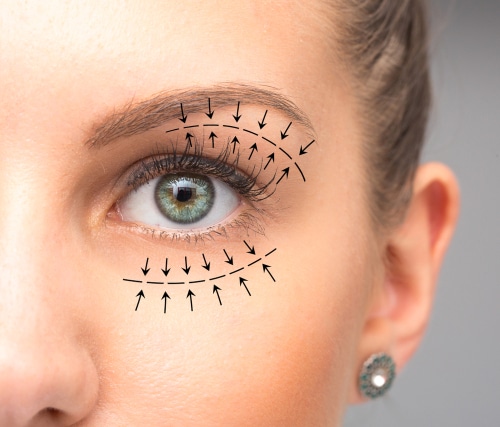 Addressing Common Concerns about Eyelift Surgery