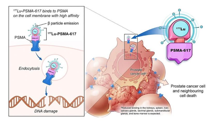  How effective is lutetium prostate cancer?