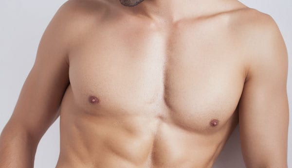  Gynecomastia Surgery in Dubai: Choosing Between Liposuction and Excision Techniques