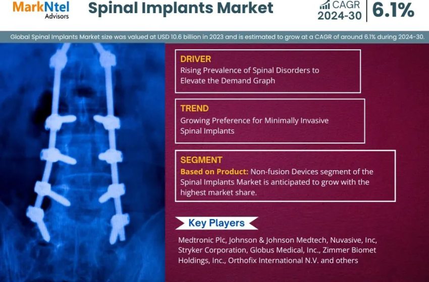  Spinal Implants Market Research: 2023 Value was 10.6 Billion and CAGR Growth Reached approximately 6.1% By 2030