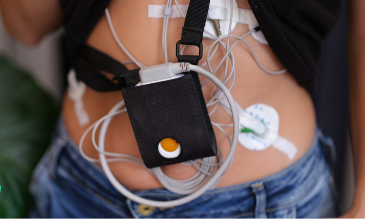  Cardiac Holter Monitor Market Size, Share And Growth Forecast 2023-2030