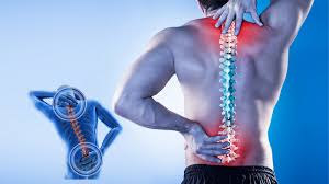 What Are the Most Effective Treatments for Chronic Back Pain?