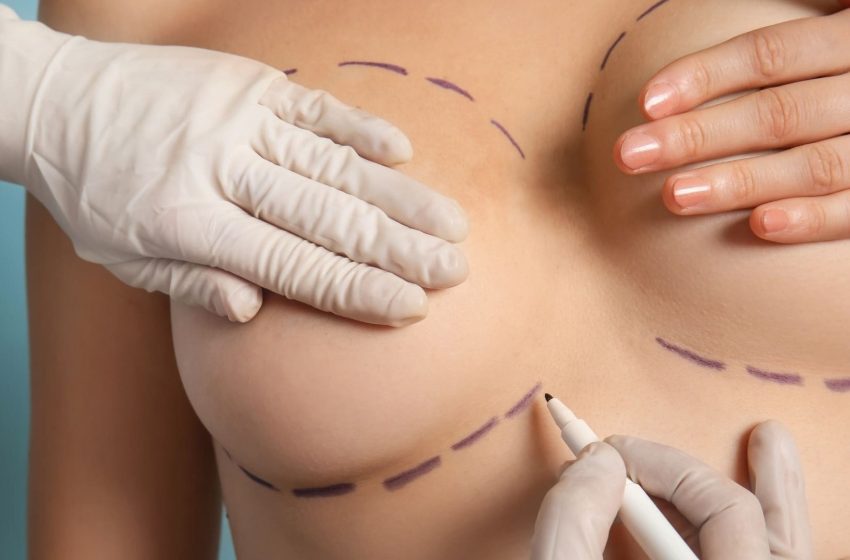  Minimizing Scarring After Breast Fat Transfer Dubai Techniques