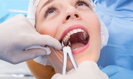  Wisdom Teeth Removal enmore | Safe & Professional Oral Surgery