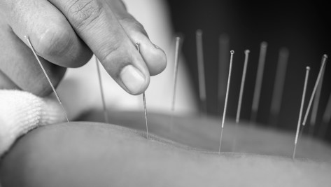  Discover the Benefits of Remedial Massage Therapy in Bayside Melbourne