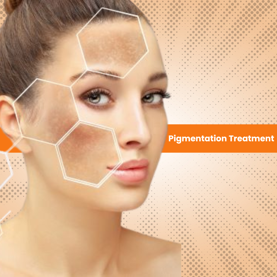 Pigmentation Treatment Kit: A Comprehensive Solution for Flawless Skin