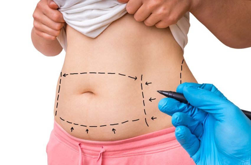  Body Contouring for Sagging Skin: Options and Solutions