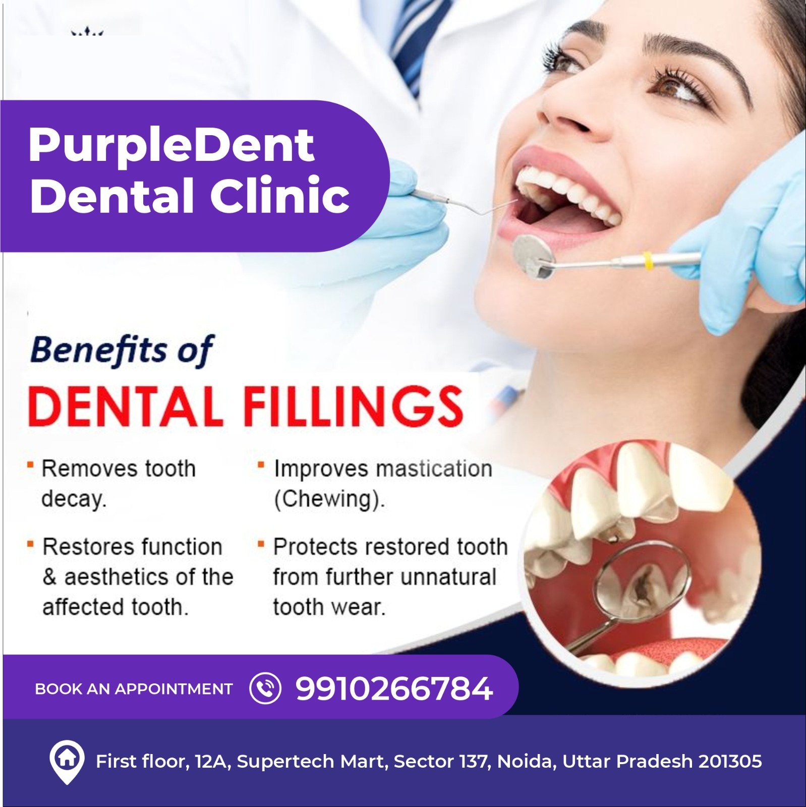  14 Ways Knowing About Dental Checkup in Noida With Purpledent