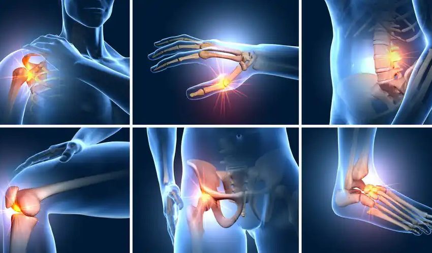  Effective Home Remedies for Relieving Muscle Pain Naturally