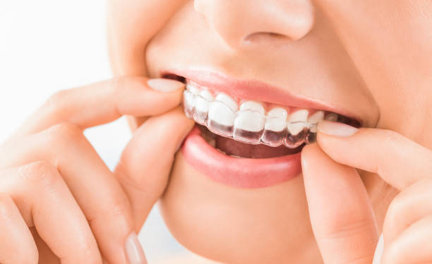  Understanding Dental Cosmetics: Enhancing Your Smile