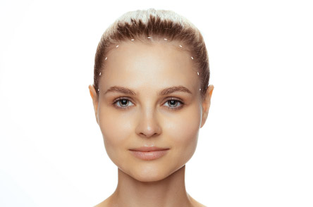  Brighten Your Face with Forehead Lift Surgery