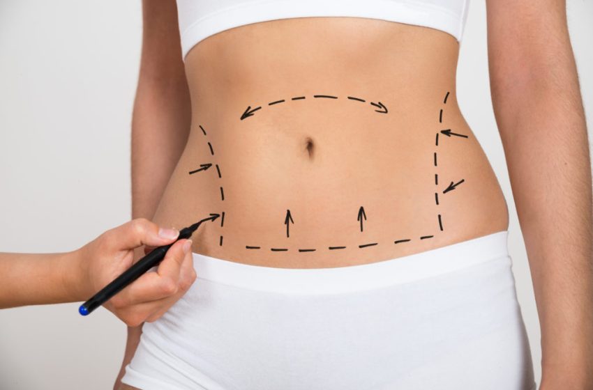  The Impact of Liposuction on Body Image and Confidence