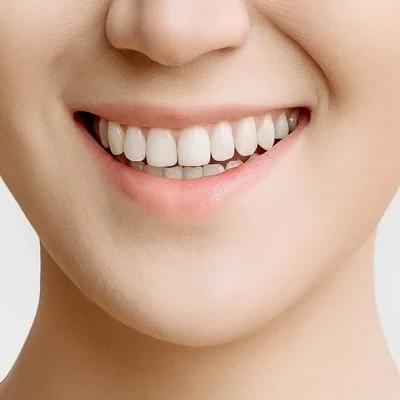 Long-Lasting Results: The Best Teeth Whitening Methods