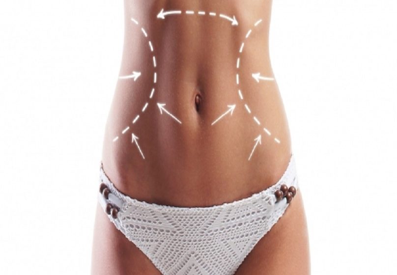  Tummy Tuck Dubai: Addressing Common Concerns