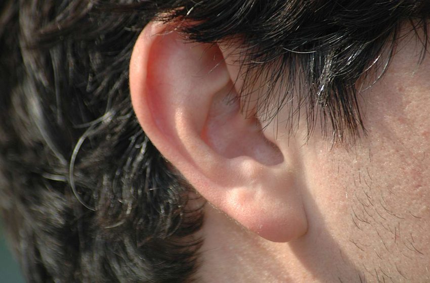  A Comprehensive Guide to Earlobe Reshaping