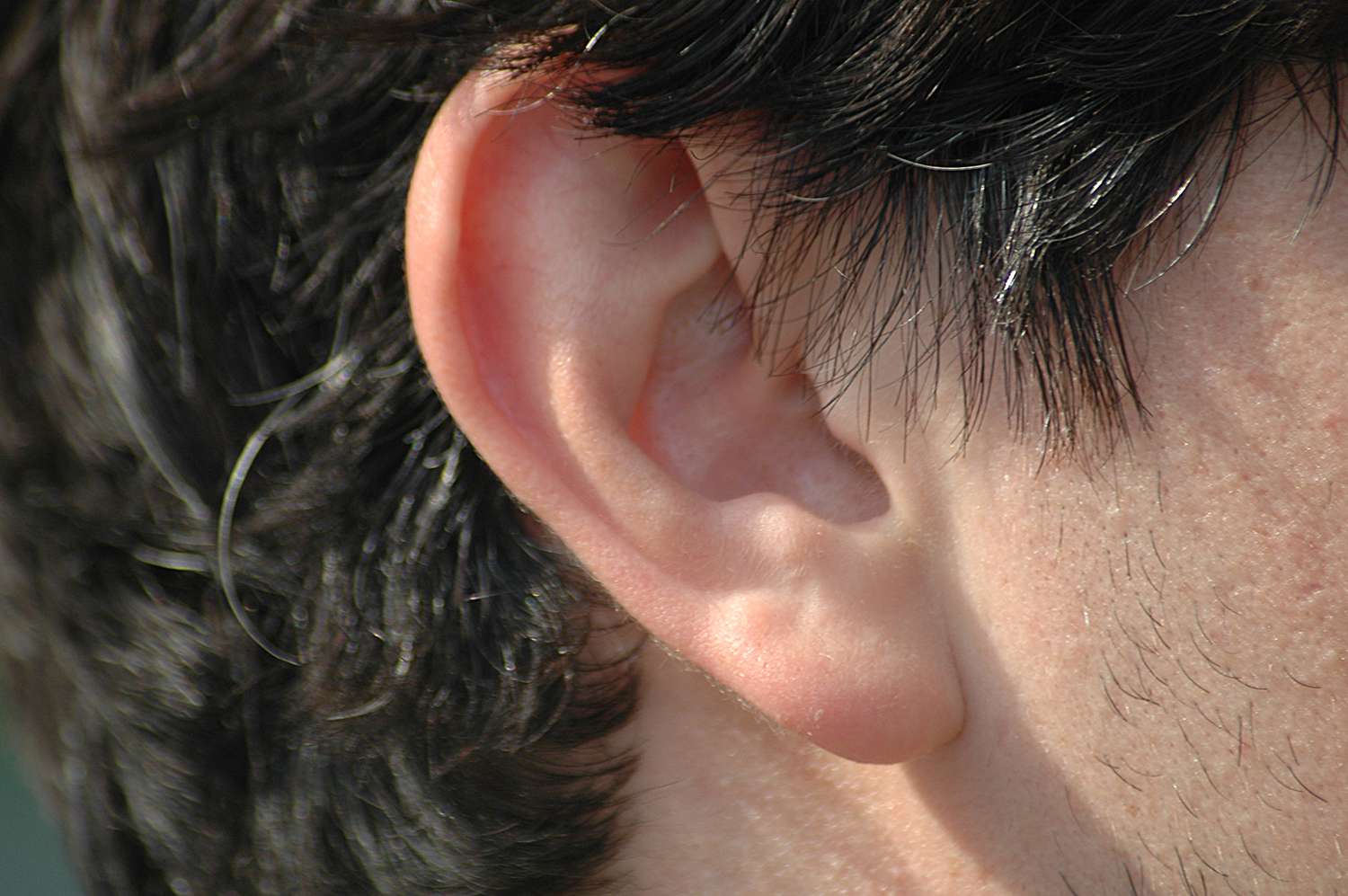 A Comprehensive Guide to Earlobe Reshaping