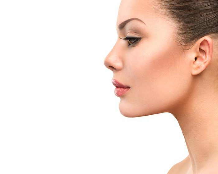  Choosing Between Open and Closed Rhinoplasty