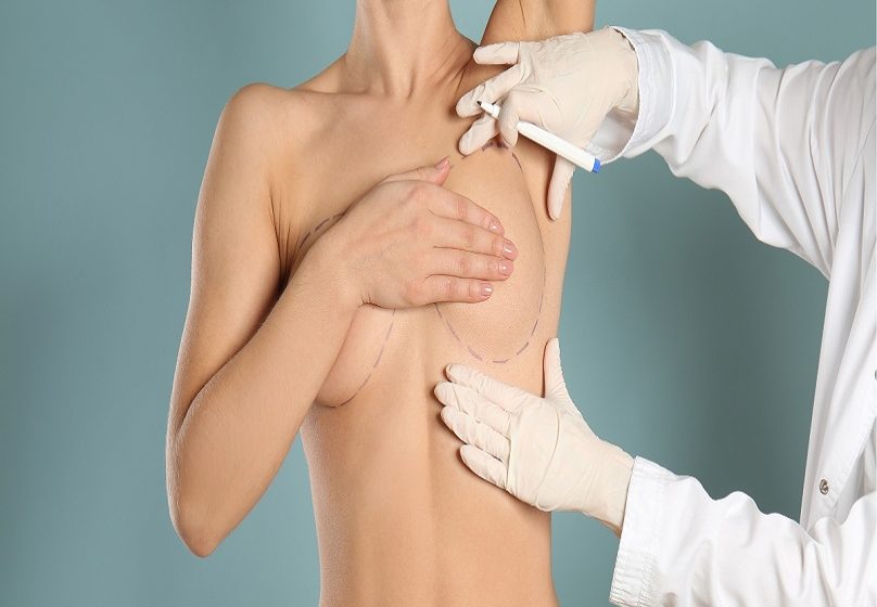  Breast Lift in Dubai: What You Need to Know