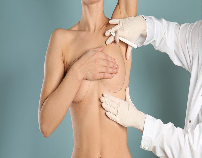 How to Prepare for Your Breast Lift Surgery in Dubai?