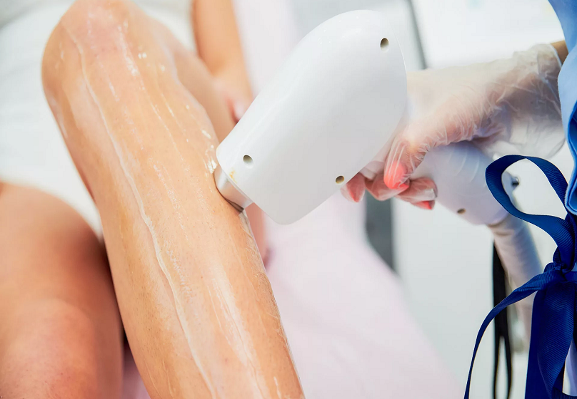  The Ultimate Guide to Laser Hair Removal in Dubai