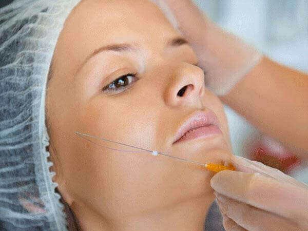  Thread Lift vs. Traditional Facelift: Which is Right for You in Dubai?