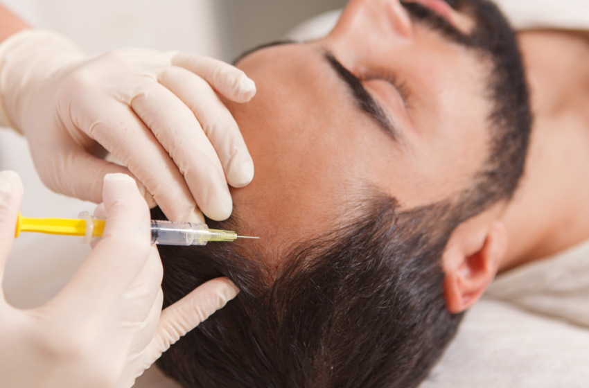  FUE Hair Transplant: Procedure and Benefits