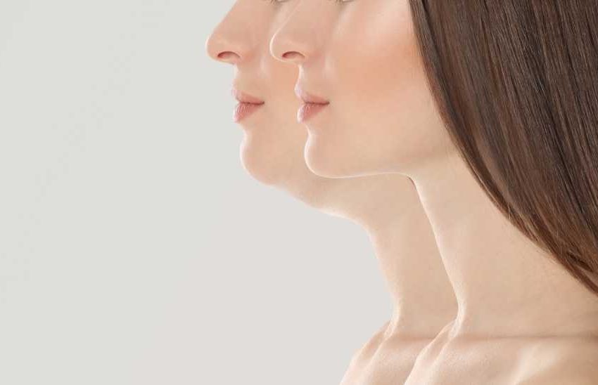  Get Rid of Your Double Chin: Liposuction Techniques and Benefits