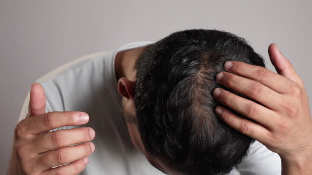  What to Expect from a Hair Transplant in Karachi