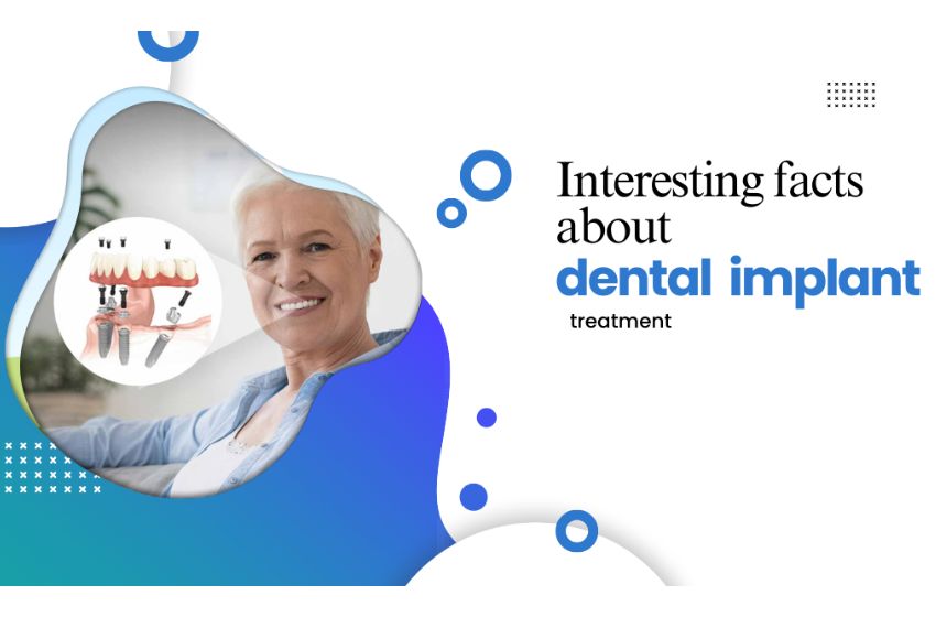  Interesting facts about dental implant treatment