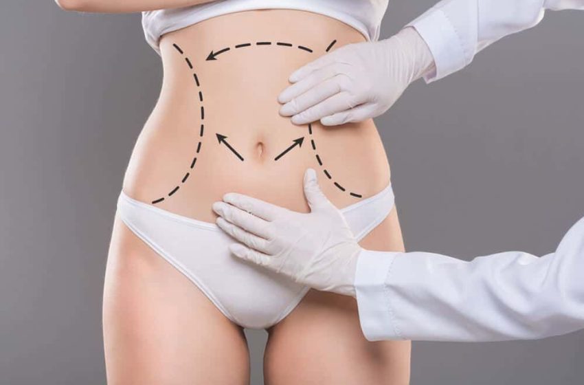  Liposuction Surgery in Dubai: What to Expect in 2024