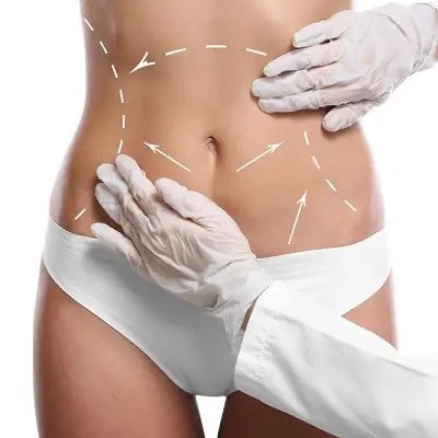  How to Choose the Best Doctors in Dubai for Your Liposuction Procedure