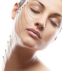 Silhouette Soft Thread Lift: Defy Gravity Without Surgery