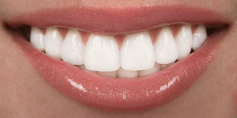 Teeth Whitening for Sensitive Teeth: Safe and Effective Solutions