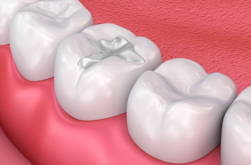  Why You Shouldn’t Wait for Restorative Dentistry in Nampa Idaho