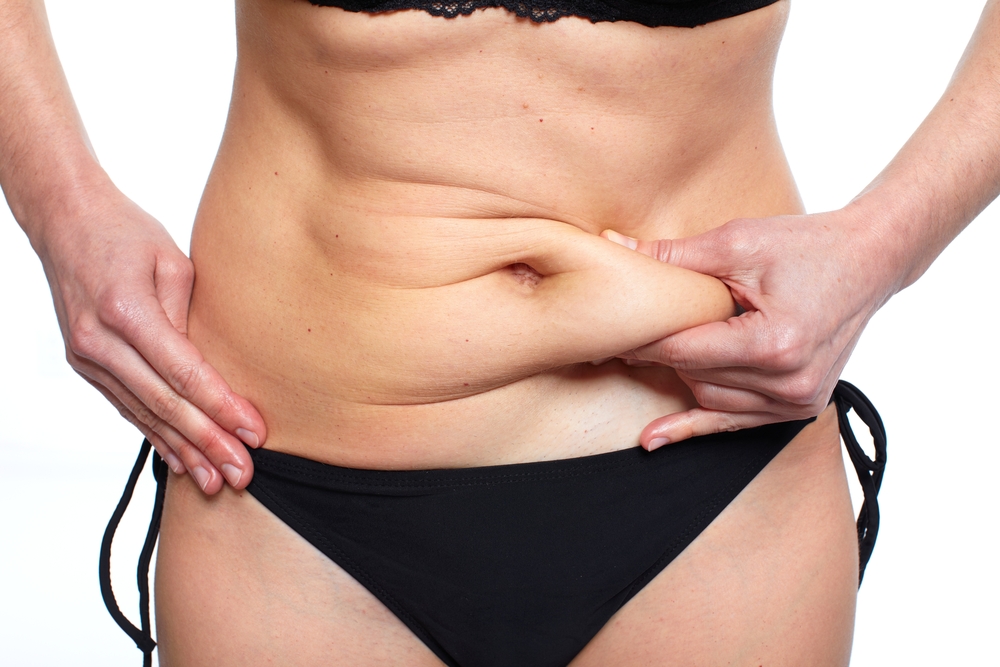 A Comprehensive Guide to Circumferential Abdominoplasty