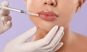 The Benefits of Lip Fillers: Enhance Your Smile Naturally