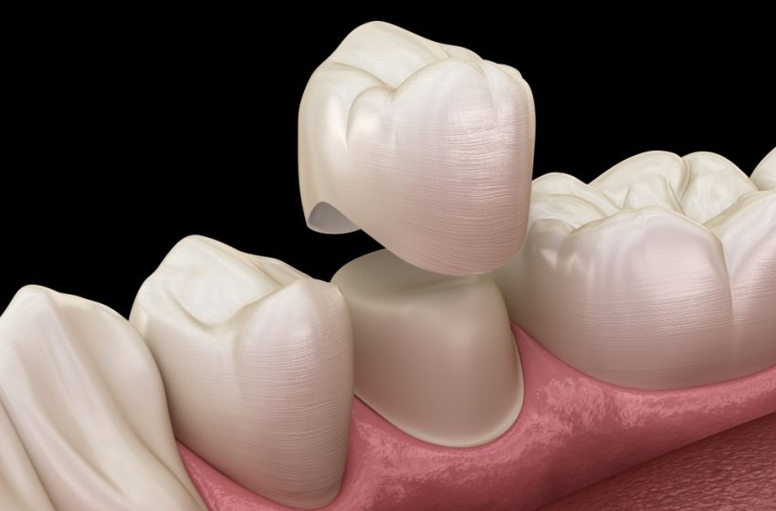  10 Tips for the Best Cosmetic Dentistry in Portland OR