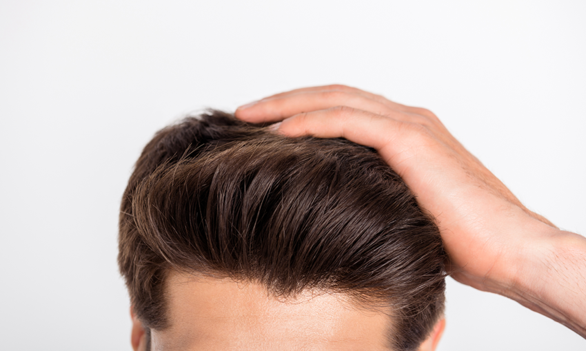  Natural Results: Achieving Realistic Outcomes with Hair Transplant