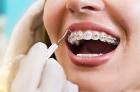 Enhance Your Smile with Cosmetic Dentistry in Nampa, ID