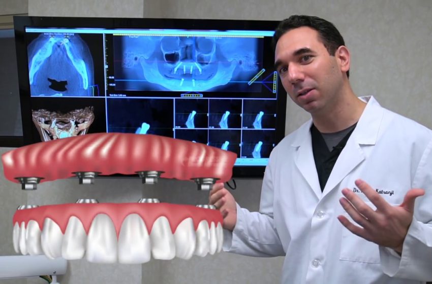  All On Four Dental Implants in Los Angeles: How It Works and Who’s a Candidate