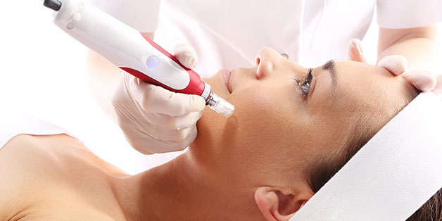  Microneedling Unveiled: Why It’s a Game-Changer for Your Skin