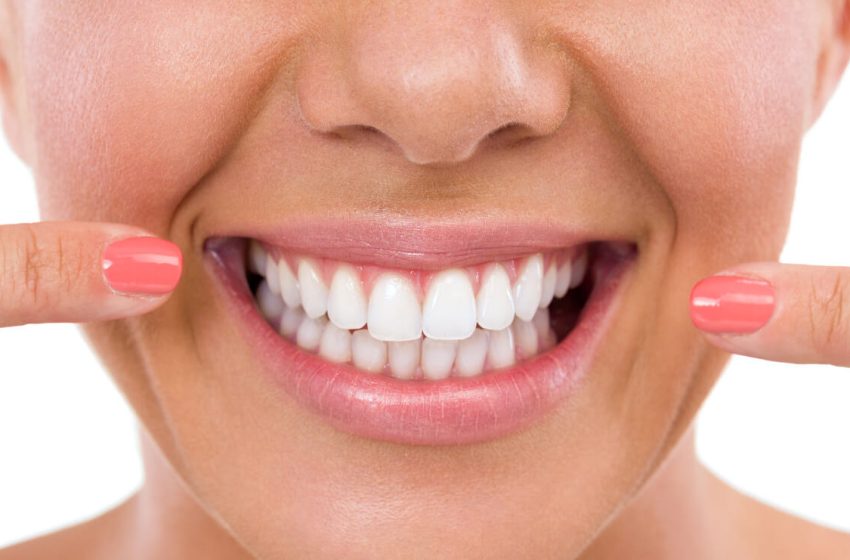  The Ultimate Guide to Professional Teeth Whitening: What You Need to Know