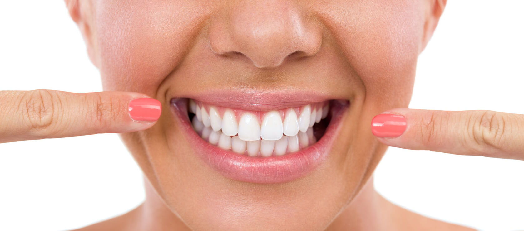 The Ultimate Guide to Professional Teeth Whitening: What You Need to Know