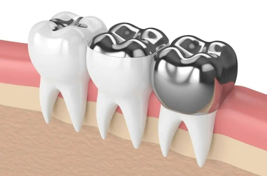  Why You Should Consider Restorative Dentistry in Nampa ID Today