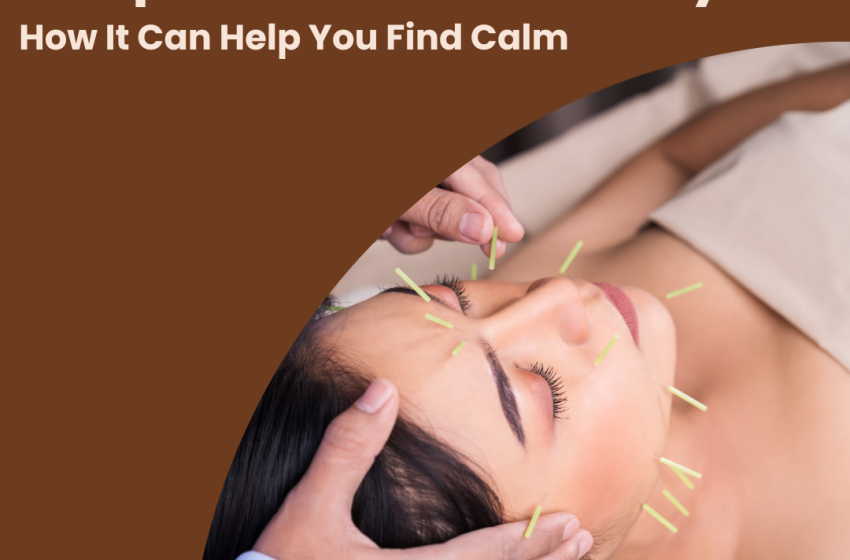  Acupuncture for Anxiety: How It Can Help You Find Calm