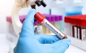  Autoimmune Disease Diagnostics Market Size And Forecast Report 2024-2030