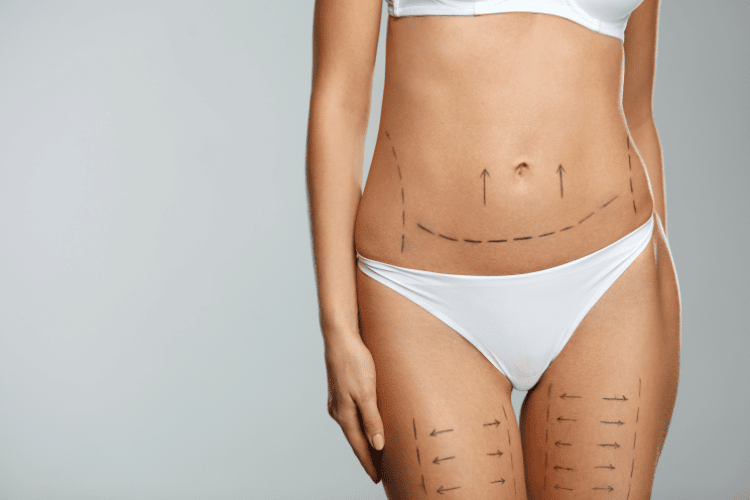 Get the Shape You Deserve with Body Contouring Solutions