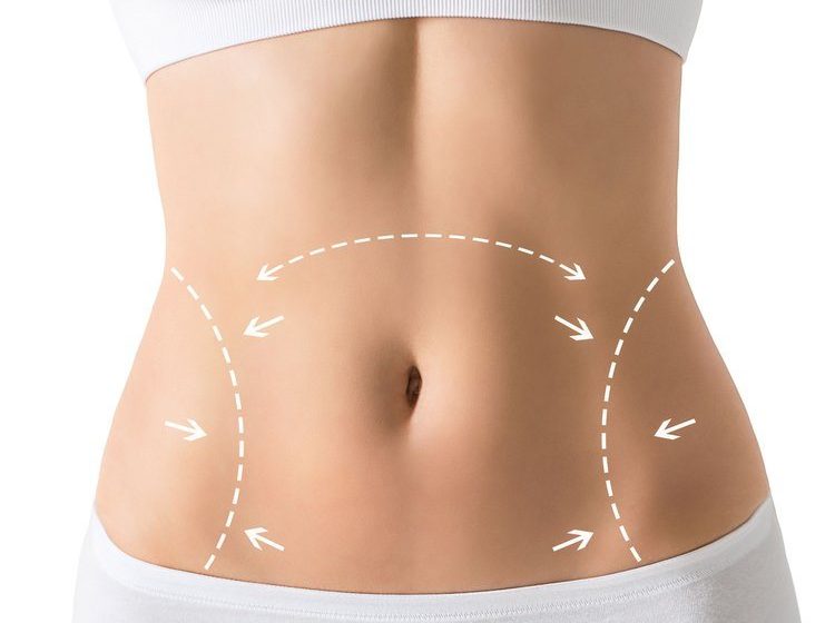  Achieve Your Dream Body : A Comprehensive Look at Tummy Tucks in Dubai