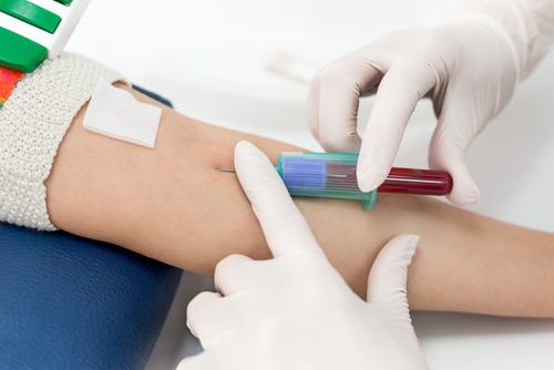  A Beginner’s Guide to Blood Tests at Home