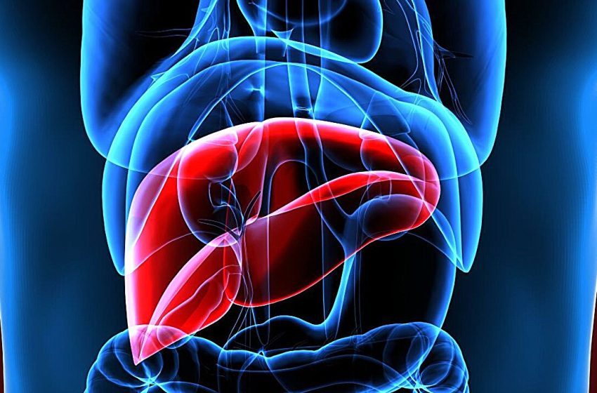  How to Find the Right Treatment for Liver Cirrhosis